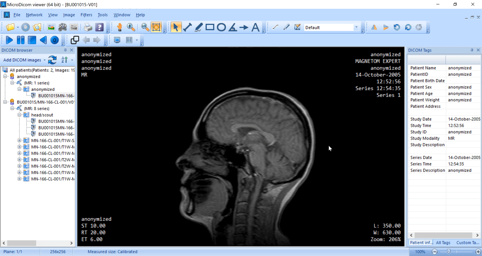 MicroDicom - Created by PostDICOM